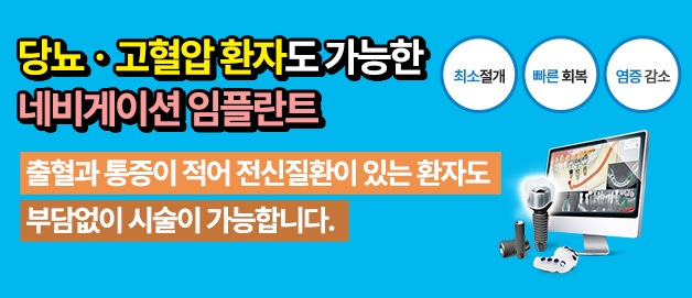 네비게이션 임플란트3