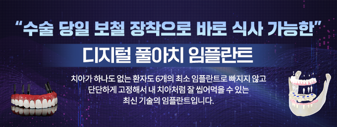 디지털 풀아치 임플란트2