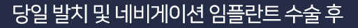 당일 발치 및 네비게이션 임플란트 수술 후
