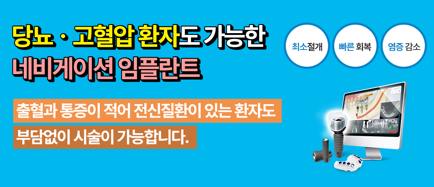 네비게이션 임플란트3